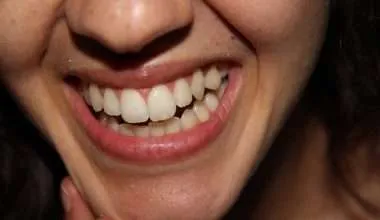 Smile-with-Natural-White-teeth